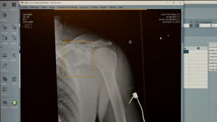 Zweitmeinung von KI bei Gesundheitsproblemen: F&uuml;r jeden Zweiten vorstellbar 