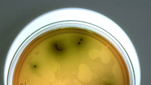 R&uuml;ckruf von Lebensmitteln: Listerien sind h&auml;ufigste Ursache