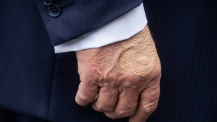 'Benign' vein issue behind Trump's swollen legs: White House