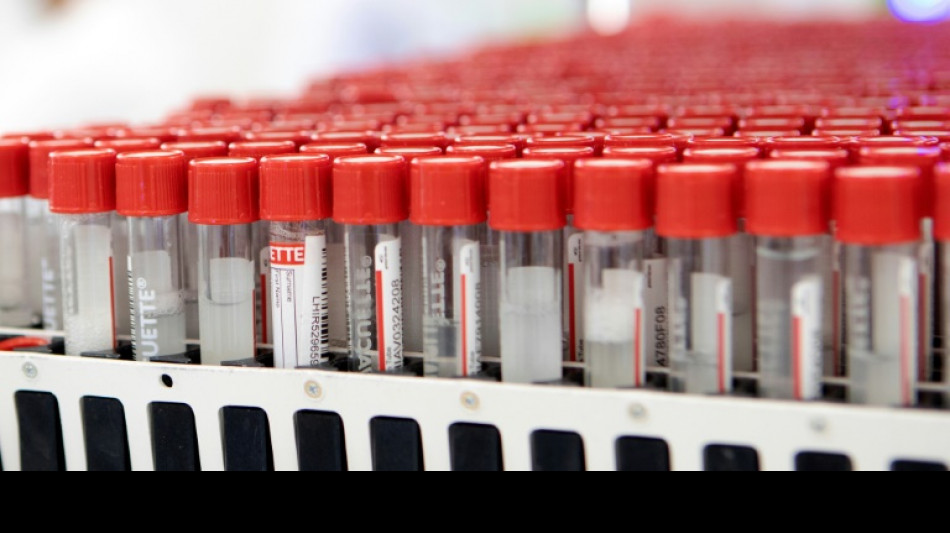 Diagnostik: Neue Methode testet Patientenproben gleichzeitig auf hunderte Viren