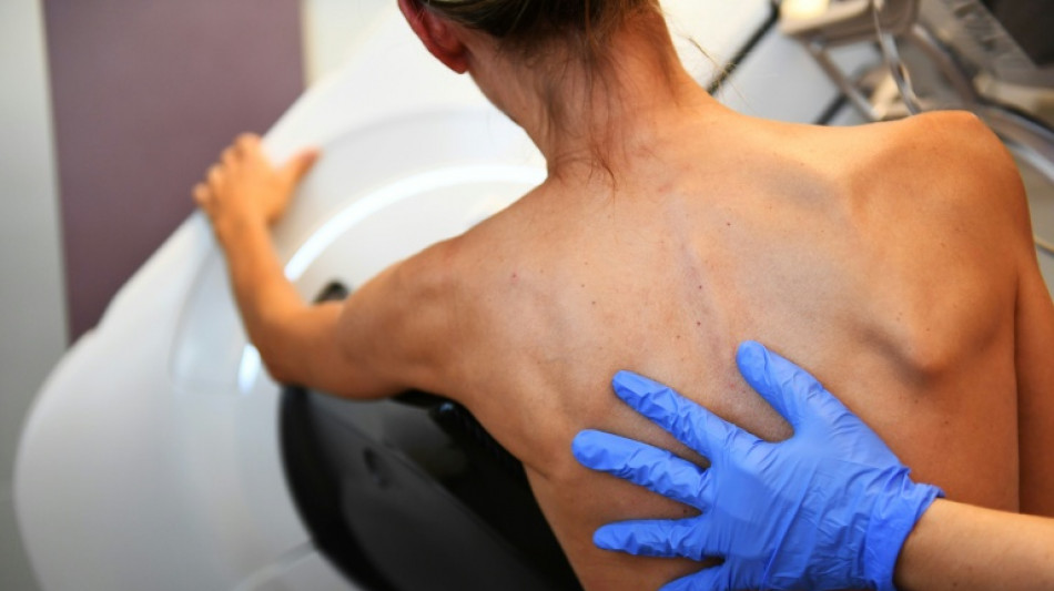 Cancer du sein: les "nombreuses lacunes" de prise en charge sous la loupe de la Cour des comptes