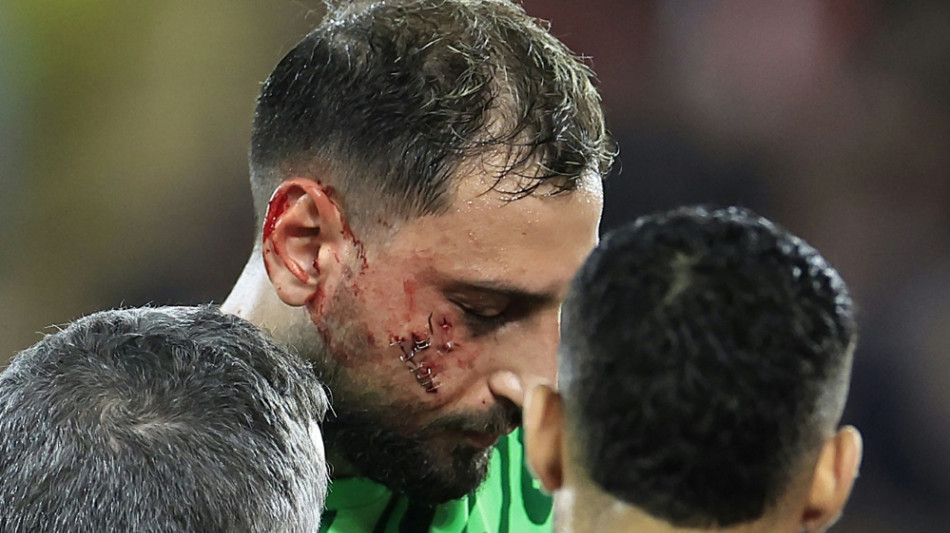 Donnarummas Stollen-Verletzung: "Man muss Spieler sch&uuml;tzen"