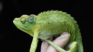 IgG4, la malattia 'camaleonte' che inganna tutti