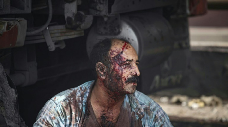 25 killed, 1,000 injured in huge Iran port blast