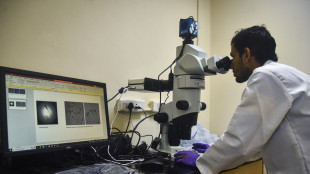 Scoperto come il cervello distingue la realtà dall'immaginazione