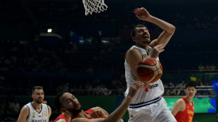Un jugador serbio pierde un ri&ntilde;&oacute;n por un golpe en el Mundial de baloncesto