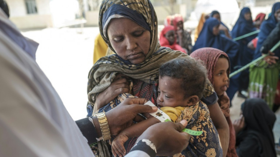 La desnutrici&oacute;n infantil se dispara en Etiop&iacute;a debido a la sequ&iacute;a