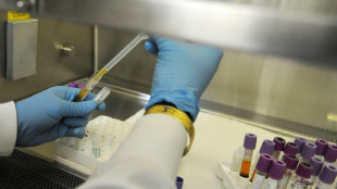 VIH: un traitement tr&egrave;s pr&eacute;coce, possible cl&eacute; d'une r&eacute;mission durable, selon une &eacute;tude