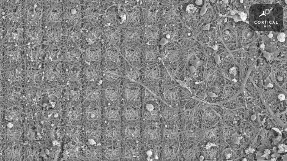 Des neurones dou&eacute;s de sensations ont appris &agrave; jouer &agrave; un jeu vid&eacute;o (&eacute;tude)