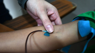 "Gwada negativo", nuevo grupo sangu&iacute;neo identificado en una mujer francesa