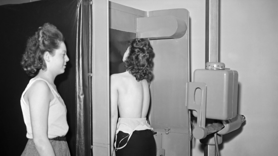 Los estereotipos de g&eacute;nero son malos para la salud