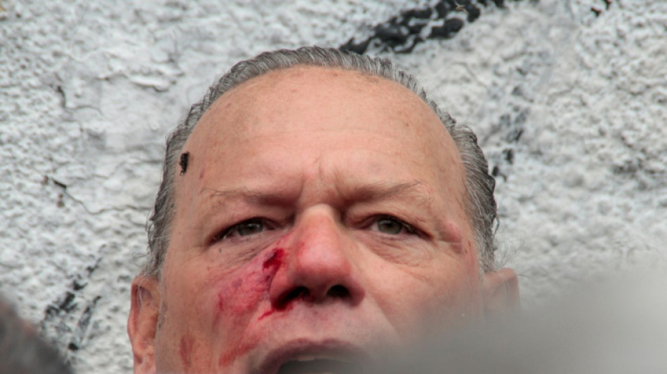 Argentine: un &eacute;lu agress&eacute; par des manifestants apr&egrave;s le meurtre d'un chauffeur de bus