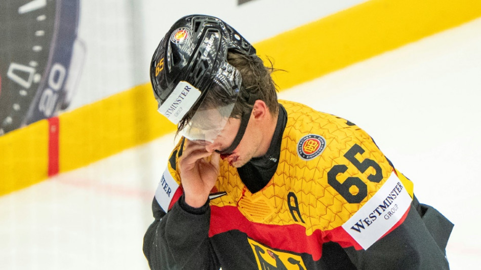 Michaelis nach Kieferbruch erfolgreich operiert