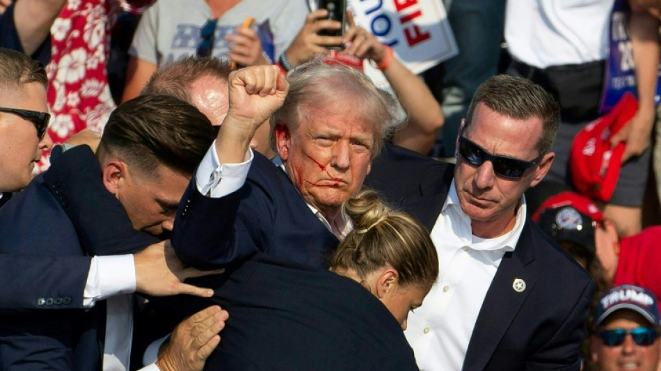 La bala que roz&oacute; a Trump dej&oacute; una herida de 2 cm en su oreja, dice un exm&eacute;dico de la Casa Blanca