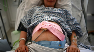 La majorit&eacute; des d&eacute;c&egrave;s li&eacute;s &agrave; une grossesse aux Etats-Unis sont &eacute;vitables (rapport)