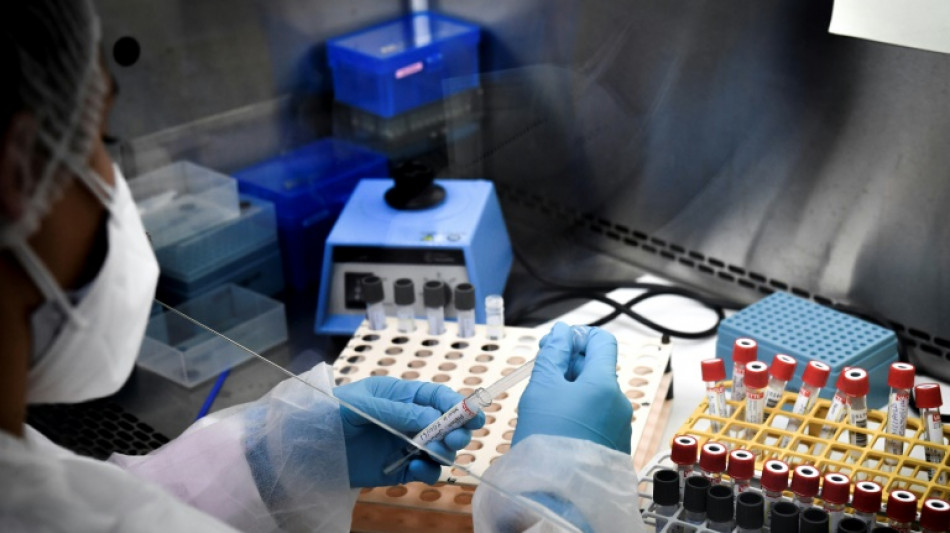 Sant&eacute;: les laboratoires de biologie en gr&egrave;ve &agrave; partir de lundi