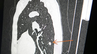"Usted tiene c&aacute;ncer", mensaje err&oacute;neo y aterrador a cientos de pacientes de una cl&iacute;nica en Inglaterra
