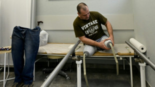 Russian prosthetics workshops fill up with wounded soldiers