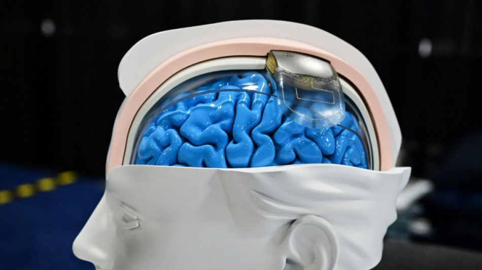 Diagnosticar doen&ccedil;as e ninar beb&ecirc;s: Feira CES apresenta novas tecnologias